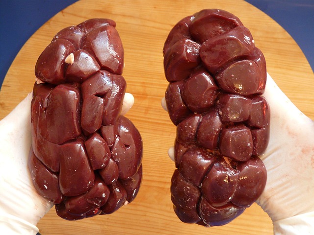 kidney
