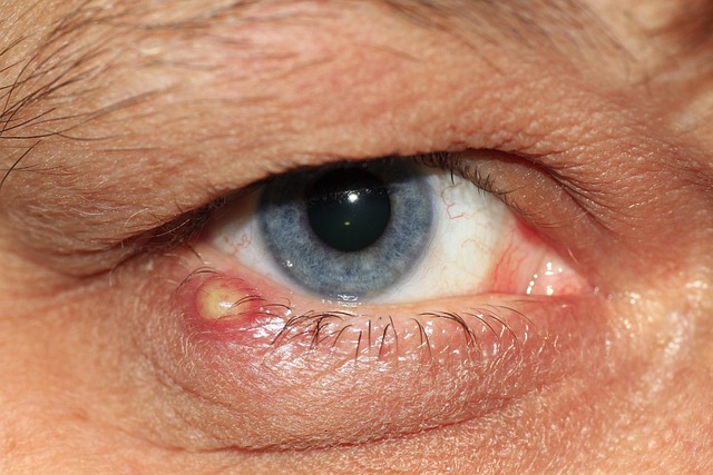 inflammation