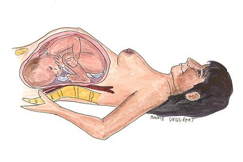 hypotensive
